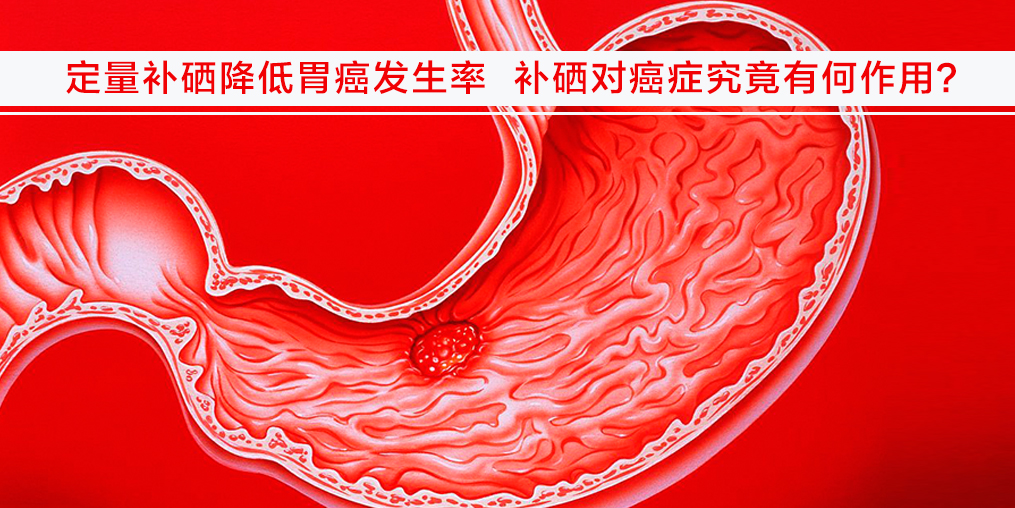 遠離胃癌不難，改變不良習慣外多補硒