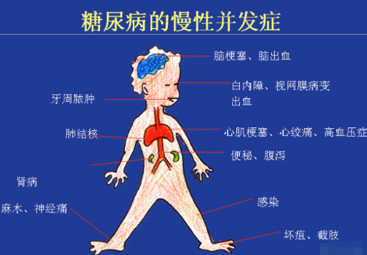 你還在害怕高血糖嗎？科學補硒不“恐糖”