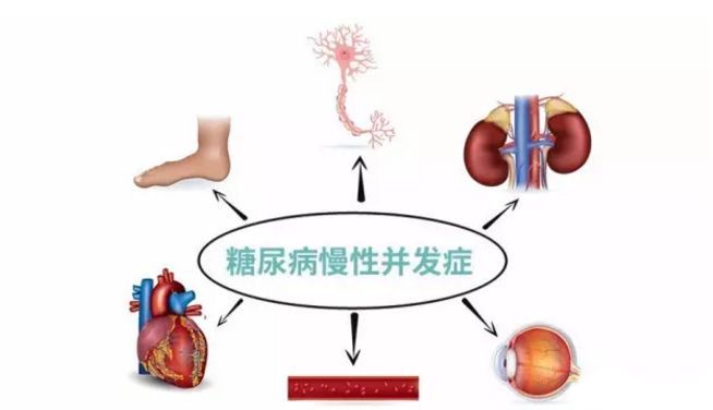 血糖波動大，并發癥來得快，糖友要多補硒